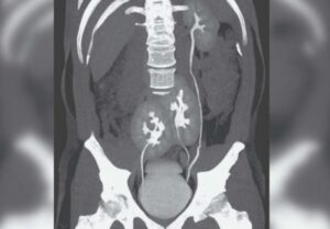 f4df976d 3890 4e9c a79f 5e4d4edafcca