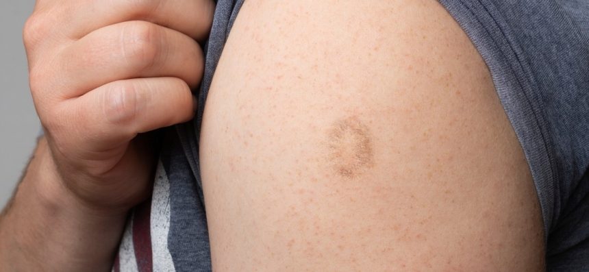 mbhgfhgfhgfhf 860x397 1