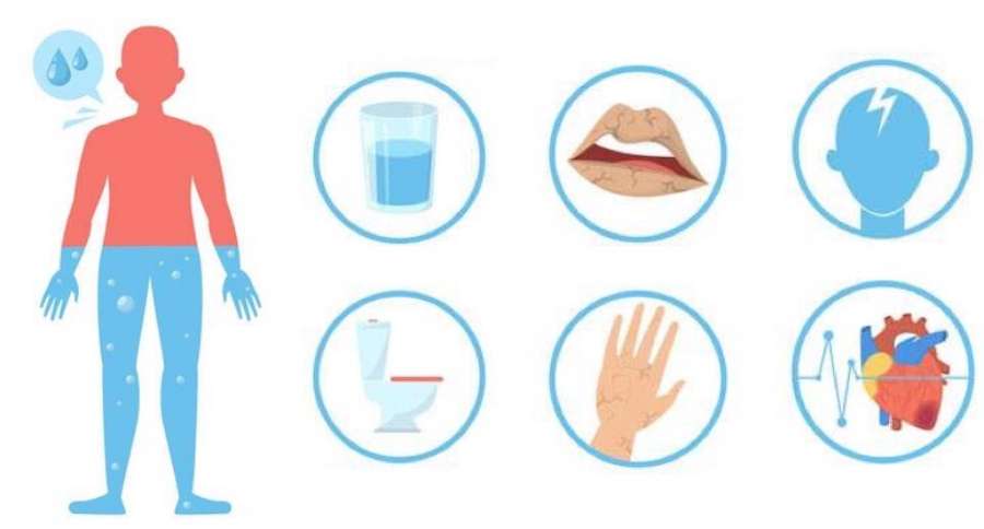 dehydratace priznaky