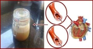 f300f05d 75fa 453e bd43 53c22e0766c0