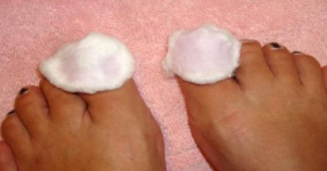 jak se zbavit plísně na nohou